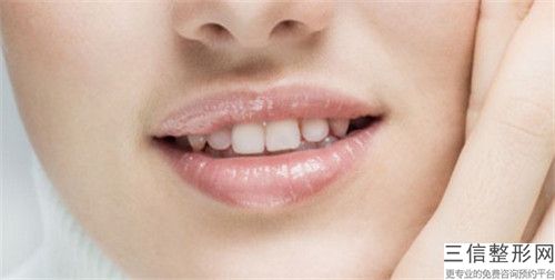 洛陽【補牙】美國3M進口樹脂Z250補牙效果圖片