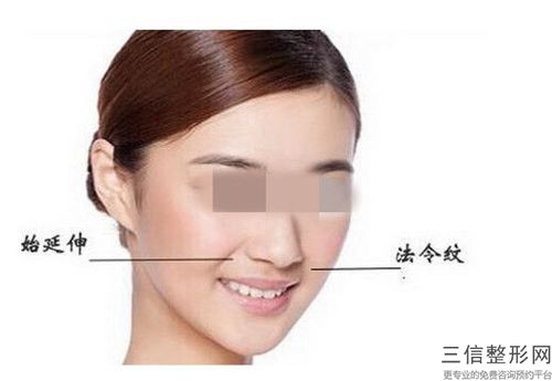 激光嫩膚除皺適應(yīng)哪些人群