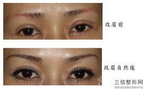 全國整形醫(yī)院紋眉術(shù)醫(yī)院：紋眉術(shù)醫(yī)院50強評出