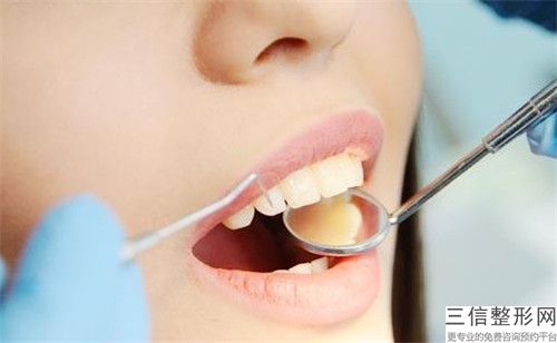濱州牙齒冷光調整整形的術后護理方法