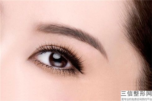 遼源水泡眼重瞼的人是哪種「遼源水泡眼重瞼手術(shù)適合什么人群呢」
