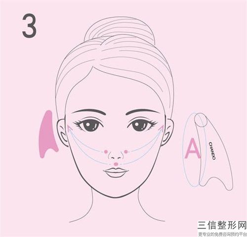 眼膜去細(xì)紋黑眼圈可能會(huì)產(chǎn)生哪些不良影響