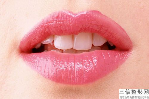 聊城門(mén)牙即刻種植術(shù)后保養(yǎng)注意事項(xiàng)有什么