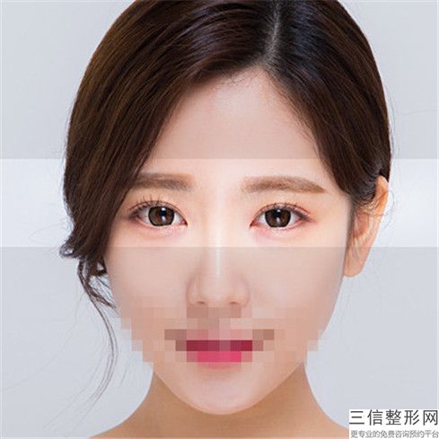 陽江fotona4d眼周做完多長時間可以看到效果