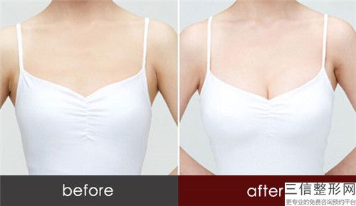 全國男士乳房吸脂醫院推薦：男士乳房吸脂醫院TOP50強公立私立對比