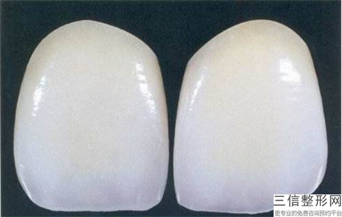 水鐳射牙齦手術(shù)術(shù)術(shù)后護(hù)理的具體情況