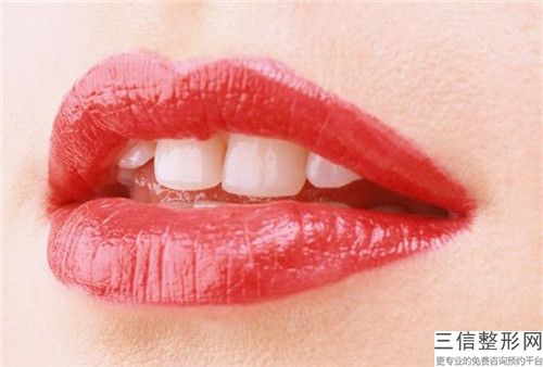 三亞內(nèi)側(cè)牙根外露整形的效果到底好不好