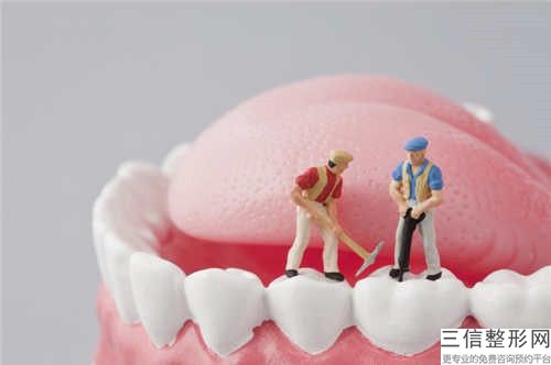 宜賓全口牙種植潛在副作用你知道嗎