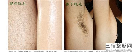 鹽津縣婦幼保健計劃生育服務中心收費明細一覽曝光-女性植發加密案例