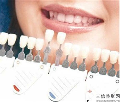 本溪牙齒矯正垂直牽引手術費用大致需要好多