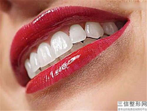 萍鄉(xiāng)牙齒過橋修復(fù)修復(fù)術(shù)能保持多久