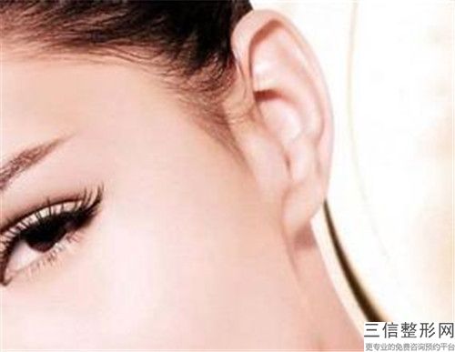 整容醫(yī)院治耳畸形推薦：治耳畸形醫(yī)院前30強(qiáng)公立盤(pán)點(diǎn)