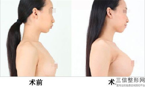 北海市人體乳房重新建造醫(yī)生排名榜top5醫(yī)生人氣榜公布-楊雙輝醫(yī)生實(shí)力細(xì)數(shù)