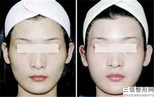 遵義貼面耳矯正的安全性與什么有關(guān)