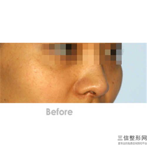 全國耳軟骨畸形醫(yī)院推薦：耳軟骨畸形醫(yī)院前50位穩(wěn)住
