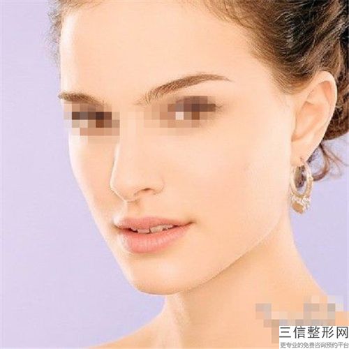 佳木斯麗顏醫療美容門診部收費明細可在線免費參考一覽-嬰兒下巴墊案例