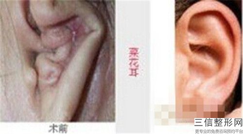 全國耳朵做整形手術醫院推薦：耳朵做整形手術醫院前50有哪個