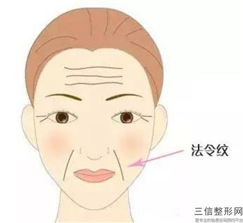 桂林市橄欖油去除妊娠紋收費標準詳情表一覽-桂林市橄欖油去除妊娠紋手術費用貴不貴呢