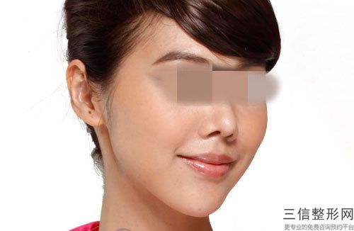 遼寧省專業下巴整形醫生哪位有實力(徐洋醫生真實案例評價看性價比高)