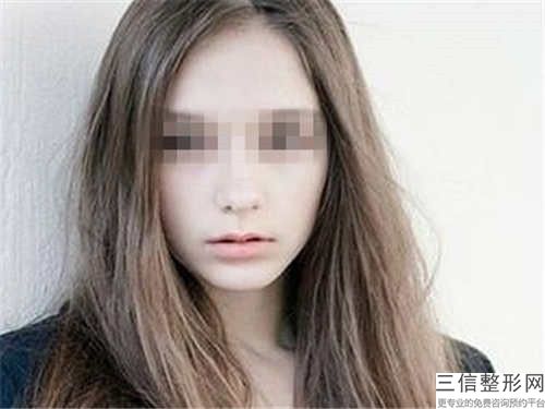 襄陽維多利亞醫療美容門診部微整形豐唇優缺點科普+案例分享