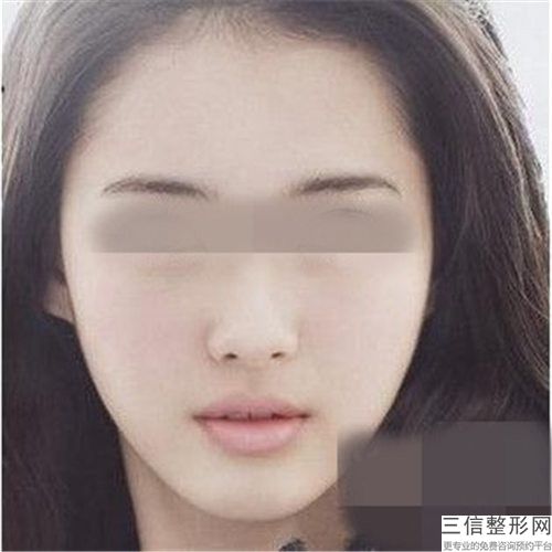 楚雄彝族自治州波尿酸隆下巴費用表明細2024新版種草推薦-楚雄彝族自治州波尿酸隆下巴好不好大概需要多少錢