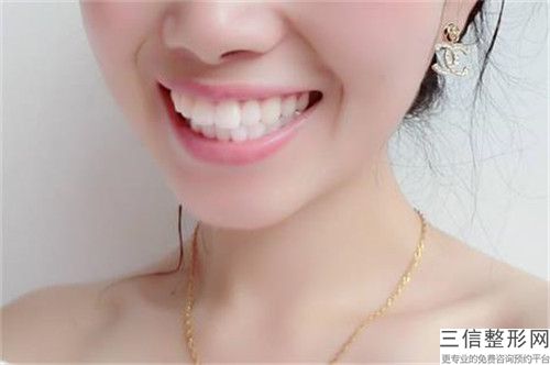 揭陽玻璃離子粘牙冠的禁忌人群及后恢復(fù)