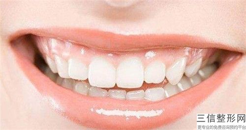 合肥鈷珞烤瓷牙安全不安全
