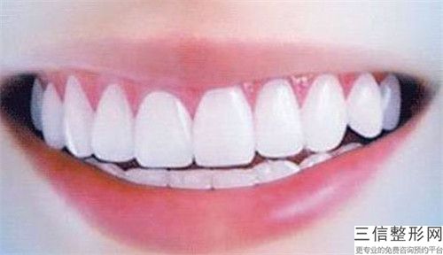 西安成人牙套手術安全嗎有沒有副作用