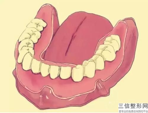 哈爾濱搭橋牙冠技術有何禁忌人群