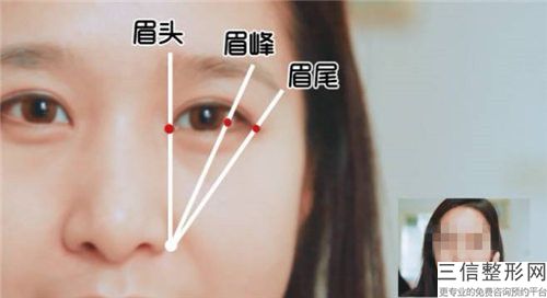 熊德成自體脂肪去眉間紋手術(shù)的方法有哪些，效果如何