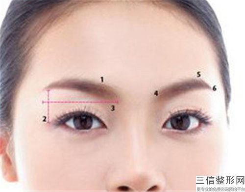 Z成形法眉位不正整形究竟能夠維持多長(zhǎng)時(shí)間