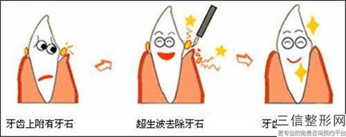 齙牙深覆合后會不會對日常生活有影響呢