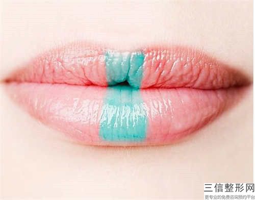 梅州兔唇治療手術(shù)術(shù)的適宜人群與禁忌人群