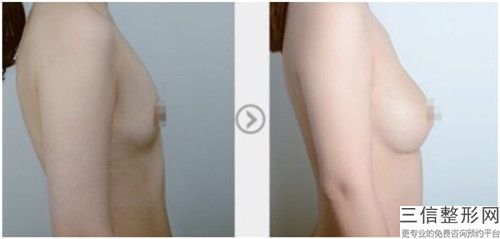 通遼乳牙牙根管開髓的價格會受到那些因素影響