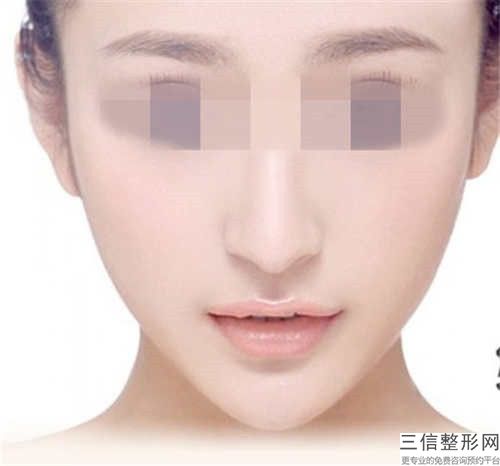 陳錦添陰唇漂紅后要做的5項(xiàng)護(hù)理