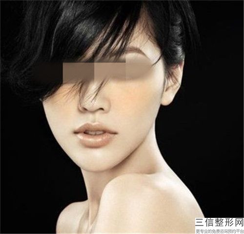 自體脂肪豐下巴術后要如何保持長久不變形