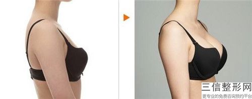 濟南市自體組織乳房再造收費標準價目表重磅來襲-近8個月均價為18637元
