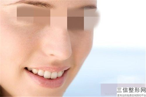 激光面部脫毛手術的術后護理事項