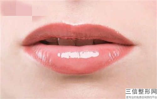 韶關先天唇裂修復后的調養和治療方法