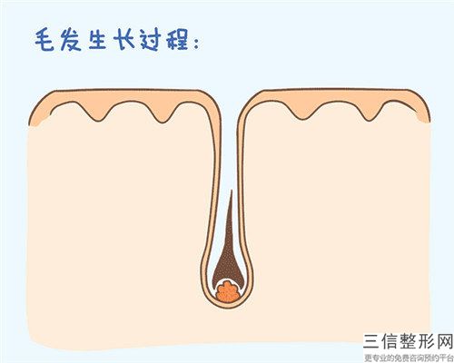 腿脫毛可能會有什么副作用-腿脫毛會有什么副作用呢