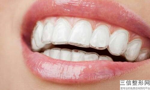全瓷牙牙齒修復(fù)術(shù)后有什么效果