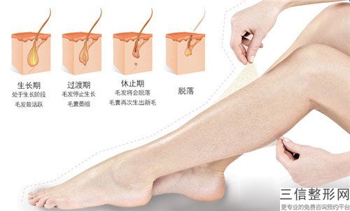 冰點激光脫毛手術有哪些方法 各有什么好處和壞處