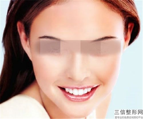 楚雄州人民醫院整形科吸脂瘦雙下巴測評筆記