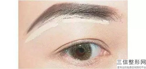 立體紋眉術手術的人群有哪些