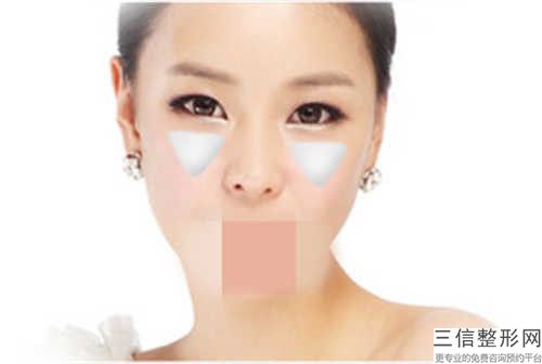 韓式顴骨消磨術手術會影響工作嗎