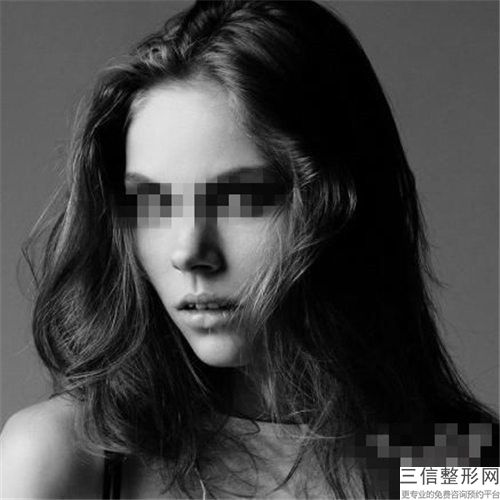 假體墊下巴哪種比較安全「假體墊下巴術到底安不安全」