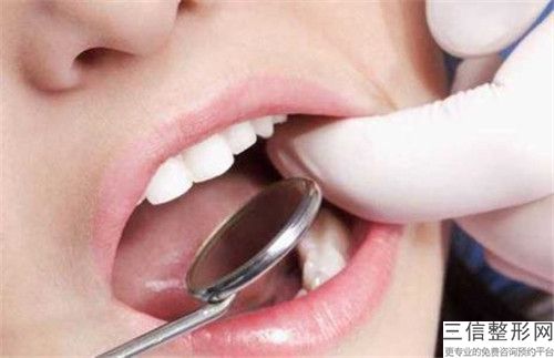 洗牙噴砂的壞處和后果有哪些