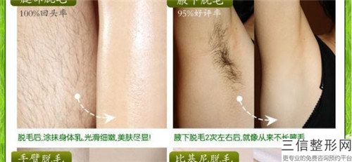 去毛細(xì)血管瘤怎么才能安全進(jìn)行