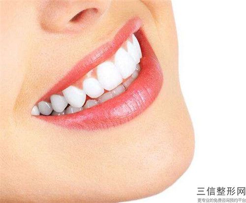 球形牙齒矯正托槽要做幾次才有效