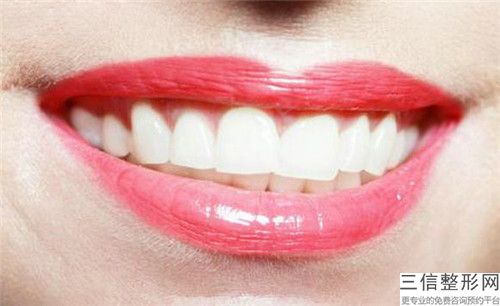 美容冠美牙齒治療后護(hù)理怎么做